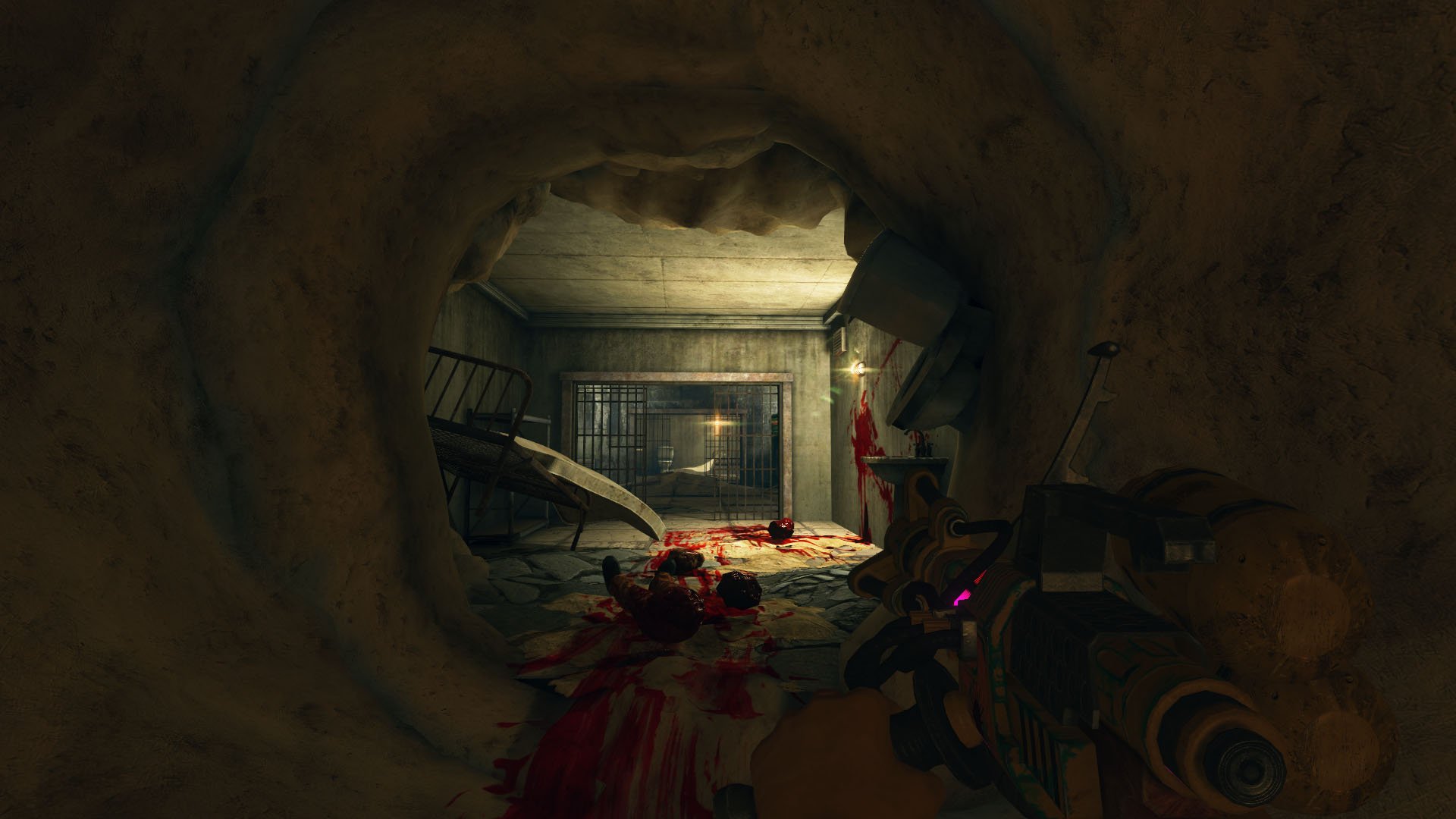 内脏清洁工/Viscera Cleanup Detail_5